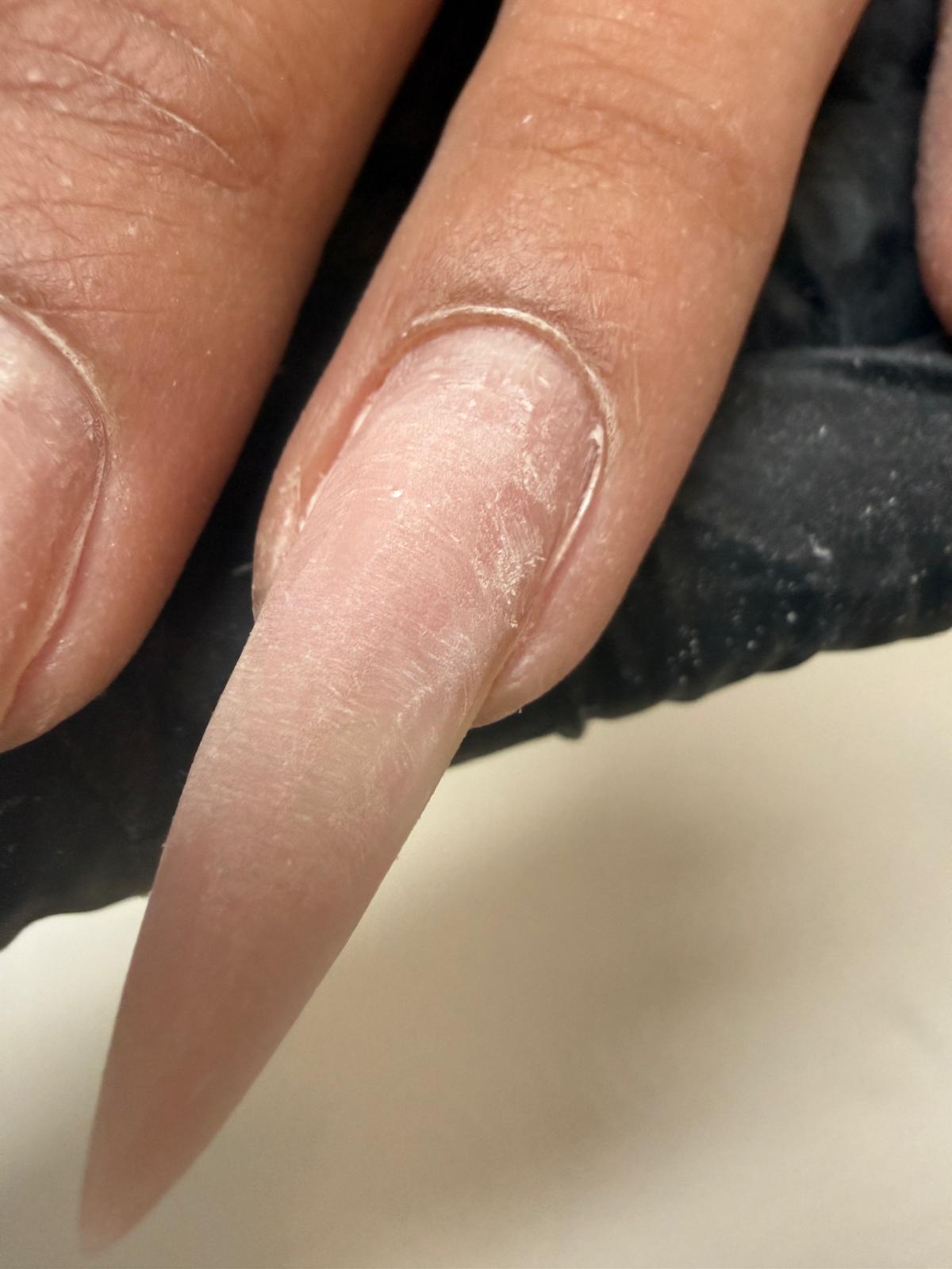 פרנץ' אלמונד ארוך